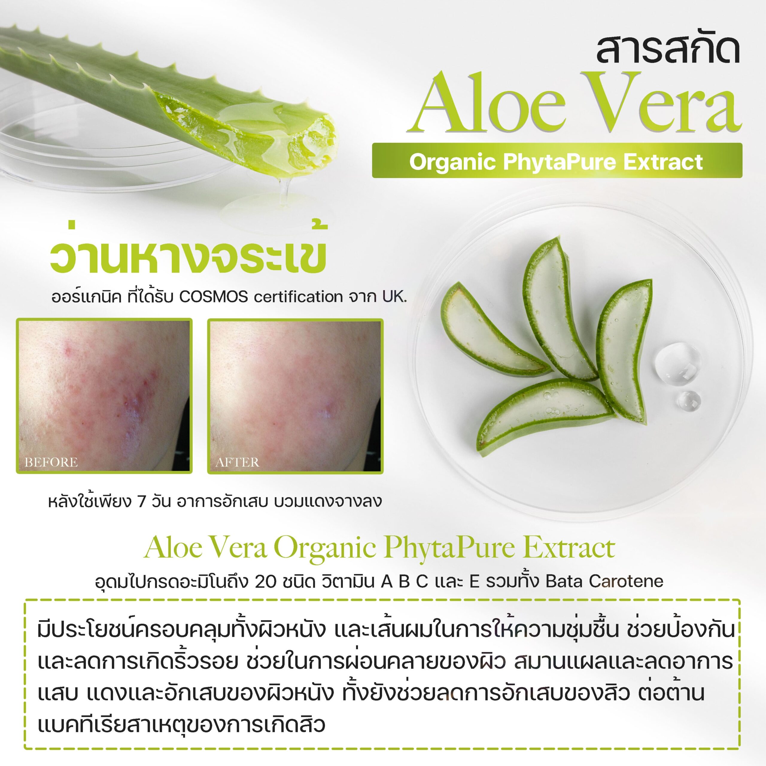 สารสกัดว่านหางจระเข้